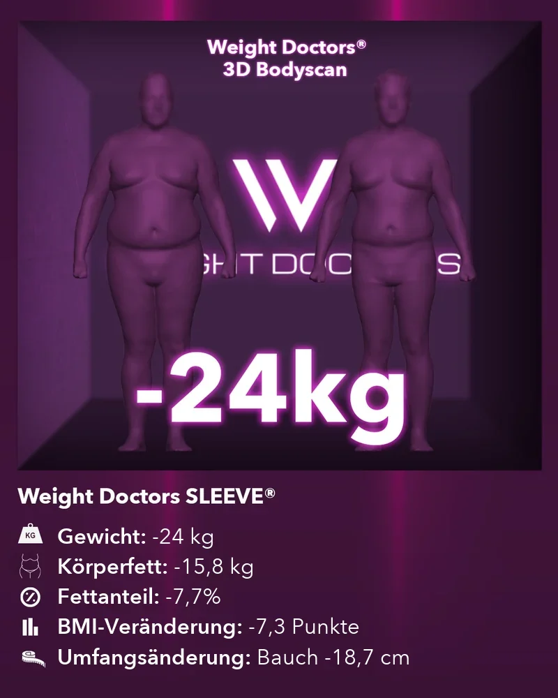 Weight Doctors® 3D-Bodyscan vorhär und nachhär: minus 24 kg mit Weight Doctors SLEEVE®, Körperfett minus 15,8 kg