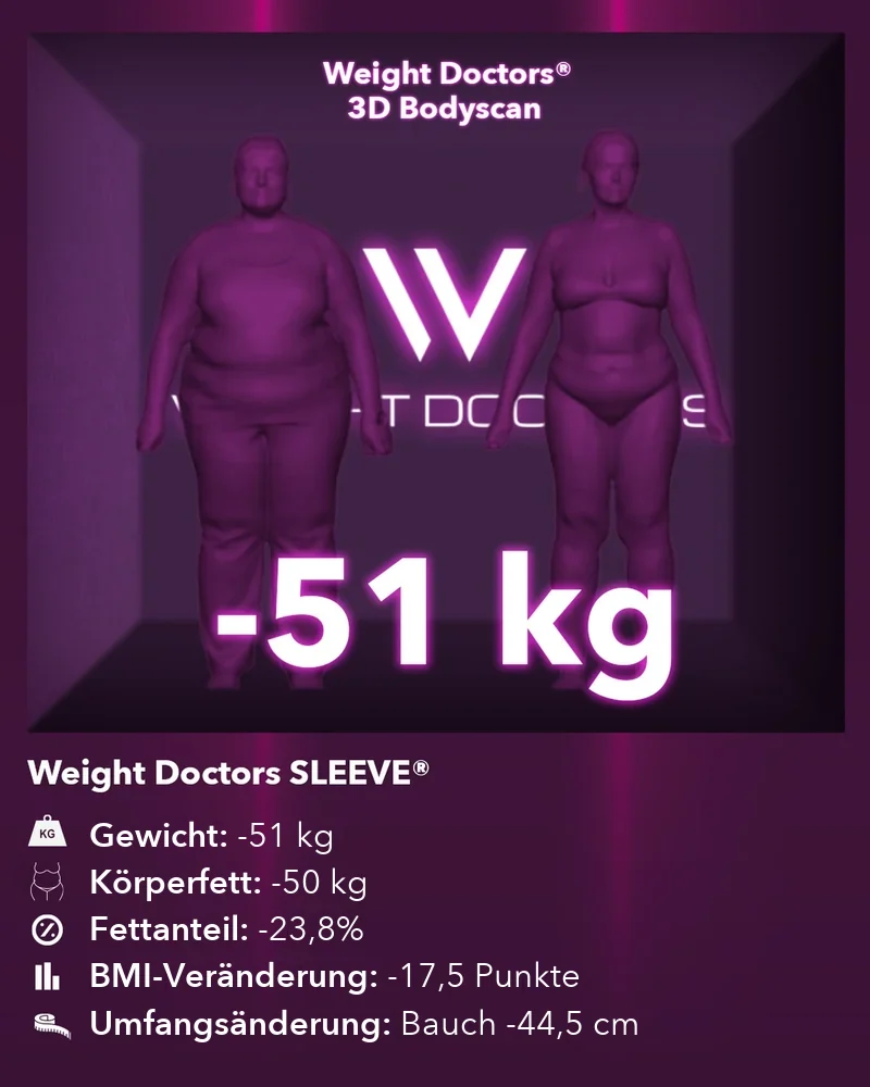 Weight Doctors® 3D-Bodyscan vorhär und nachhär: minus 51 kg mit Weight Doctors SLEEVE®, Körperfett minus 50 kg