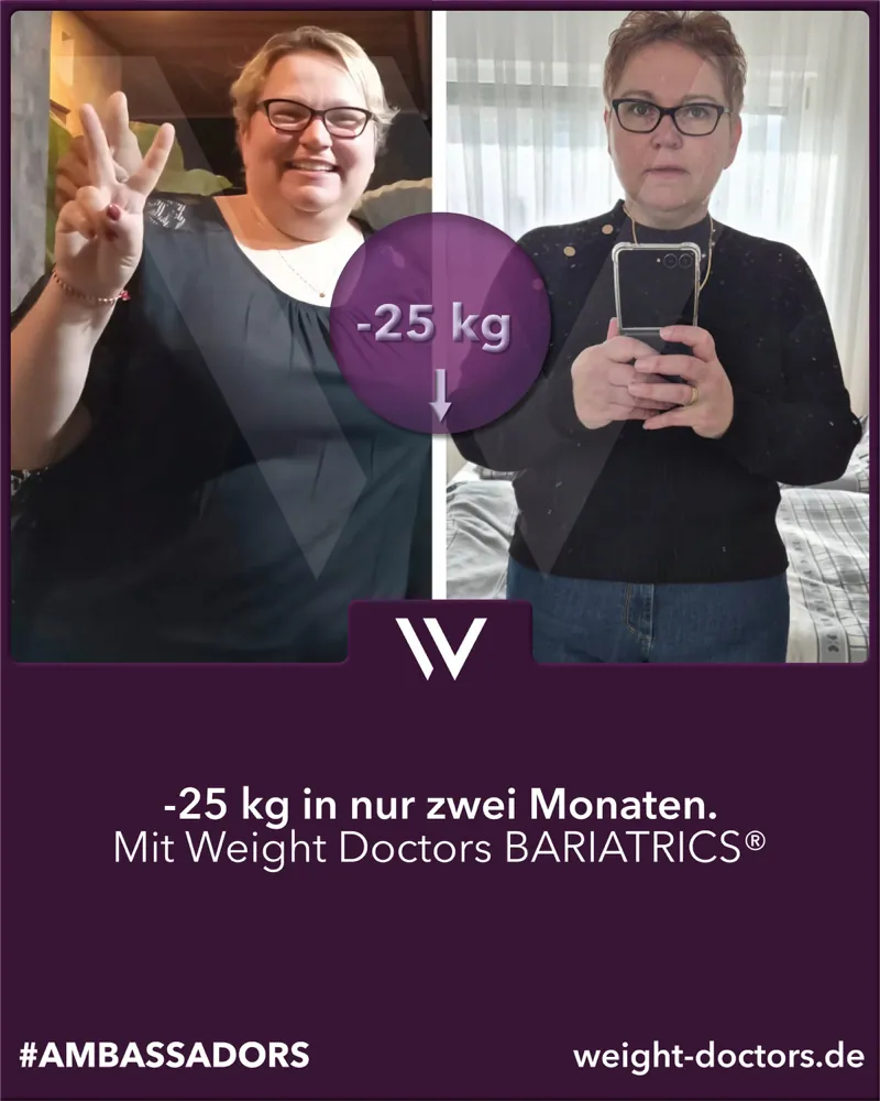 Weight Doctors® Vorher-Nachher: Patientin mit 25 kg weniger in zwei Mönet, mit Weight Doctors BARIATRICS®