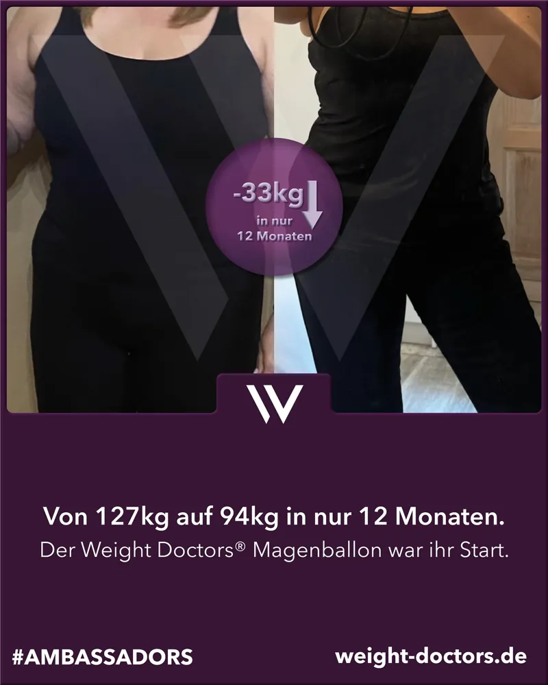Weight Doctors® Vorher-Nachher: Patientin vo 127 kg uf 94 kg in zwölf Mönet, mit em Weight Doctors® MAGENBALLON