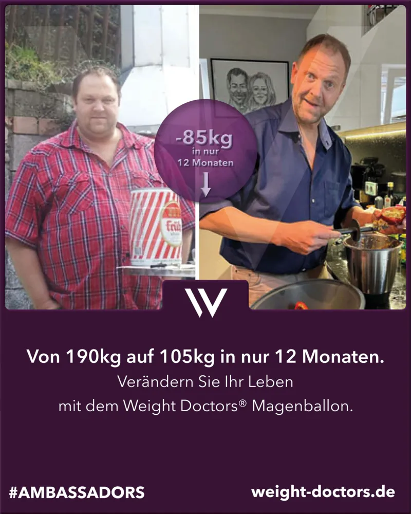 Weight Doctors® Vorher-Nachher: Patient vo 190 kg uf 105 kg in zwölf Mönet, mit em Weight Doctors® MAGENBALLON