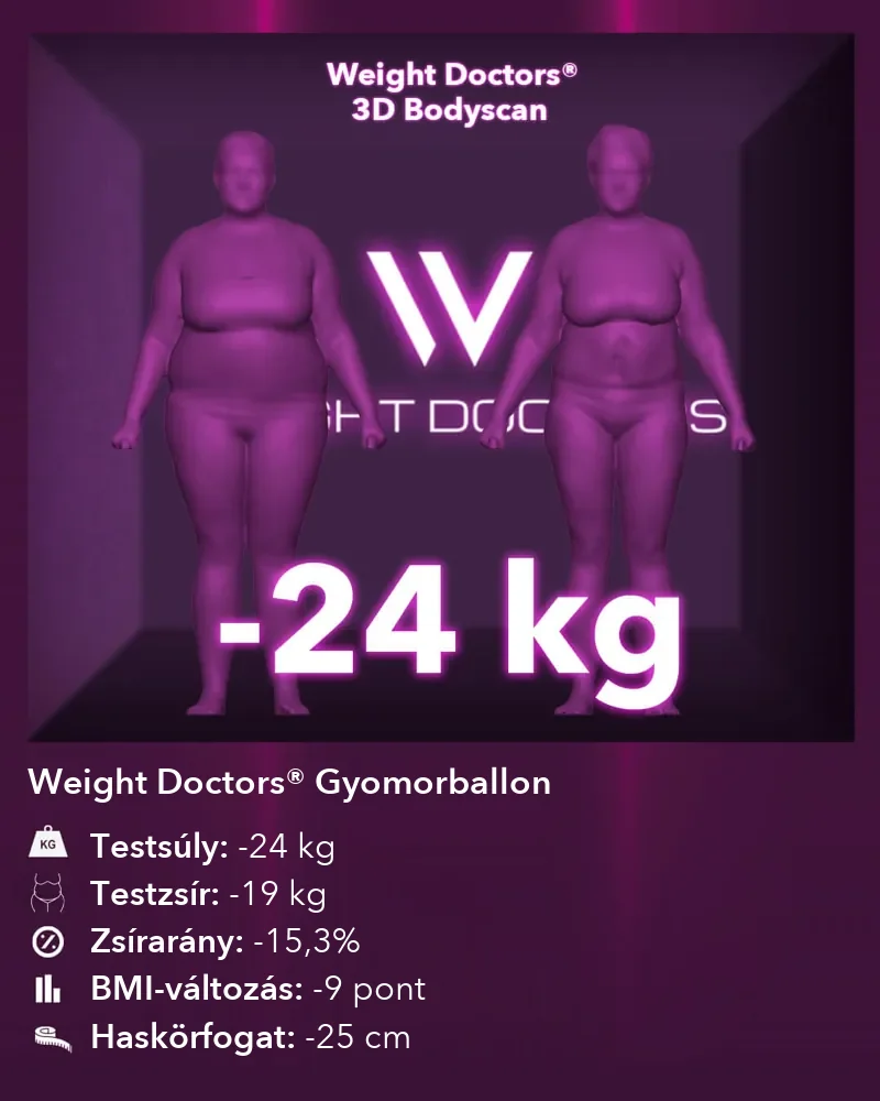 Weight Doctors® 3D Bodyscan előtte és utána: mínusz 24 kg a Weight Doctors® GYOMORBALLON segítségével, testzsír mínusz 19 kg