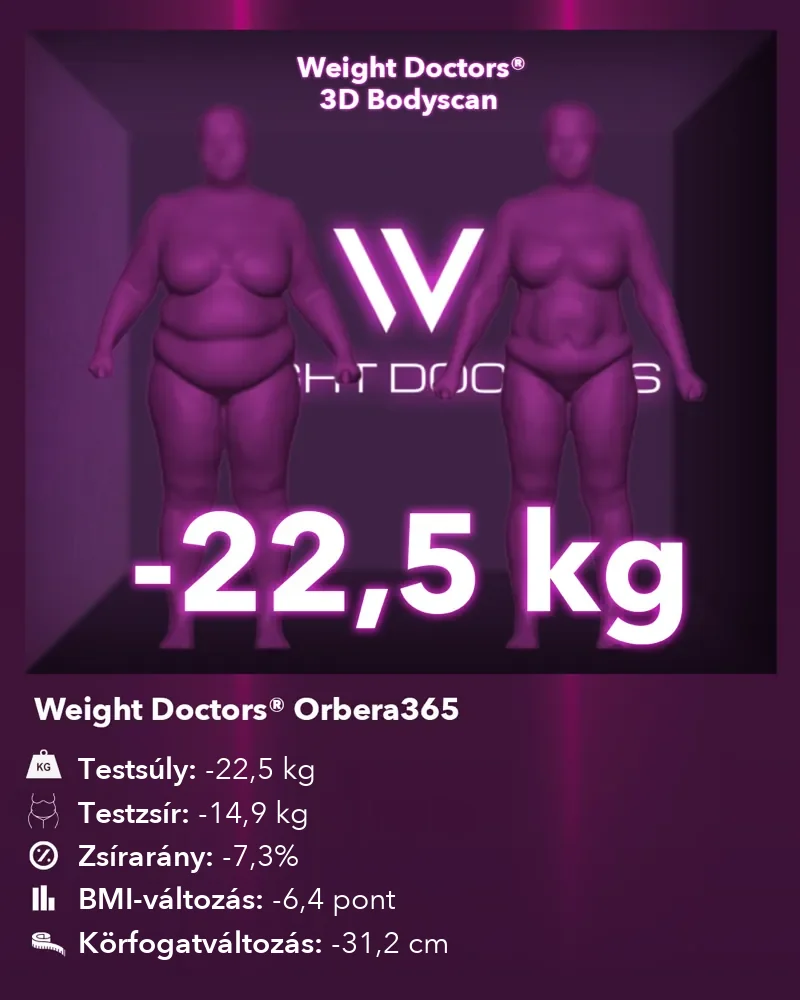 Weight Doctors® 3D Bodyscan előtte és utána: mínusz 22,5 kg az Orbera365 gyomorballon segítségével, testzsír mínusz 14,9 kg
