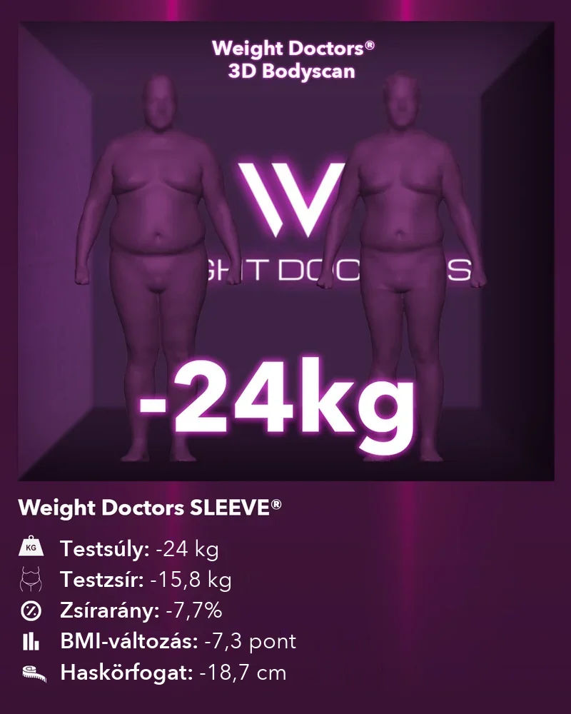 Weight Doctors® 3D Bodyscan előtte és utána: mínusz 24 kg a Weight Doctors SLEEVE® segítségével, testzsír mínusz 15,8 kg