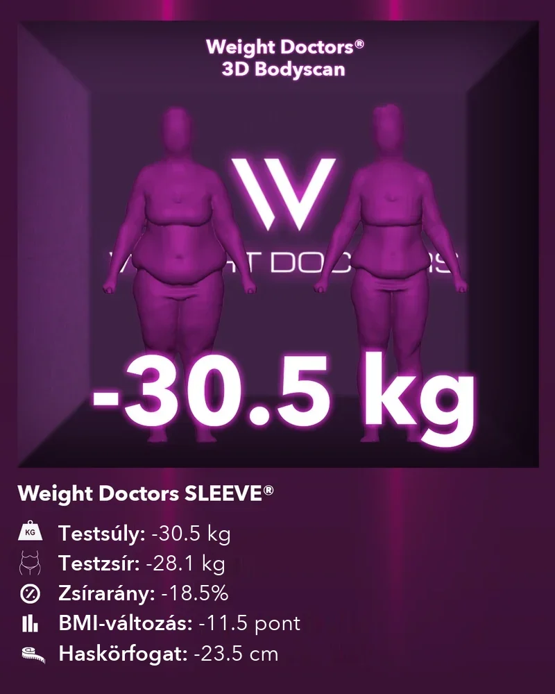 Weight Doctors® 3D Bodyscan előtte és utána: mínusz 30,5 kg a Weight Doctors SLEEVE® segítségével, testzsír mínusz 28,1 kg