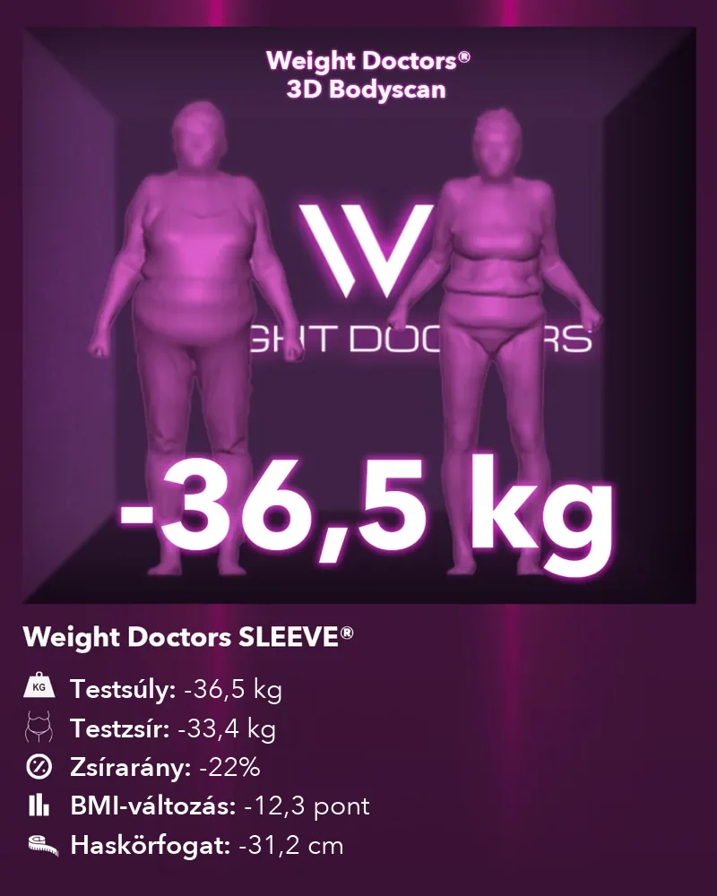 Weight Doctors® 3D Bodyscan előtte és utána: mínusz 36,5 kg a Weight Doctors SLEEVE® segítségével, testzsír mínusz 33,4 kg