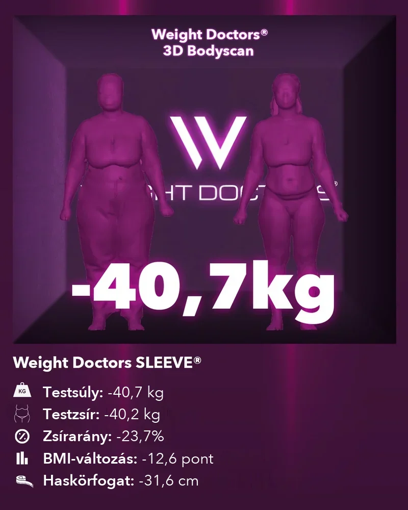 Weight Doctors® 3D Bodyscan előtte és utána: mínusz 40,7 kg a Weight Doctors SLEEVE® segítségével, testzsír mínusz 40,2 kg
