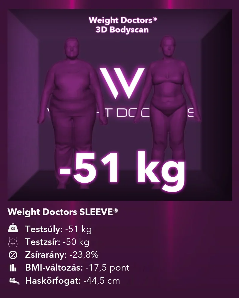 Weight Doctors® 3D Bodyscan előtte és utána: mínusz 51 kg a Weight Doctors SLEEVE® segítségével, testzsír mínusz 50 kg
