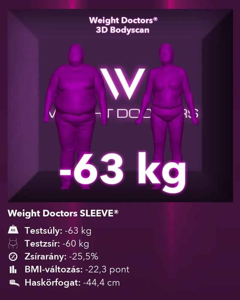 Weight Doctors® 3D Bodyscan előtte és utána: mínusz 63 kg a Weight Doctors SLEEVE® segítségével, testzsír mínusz 60 kg