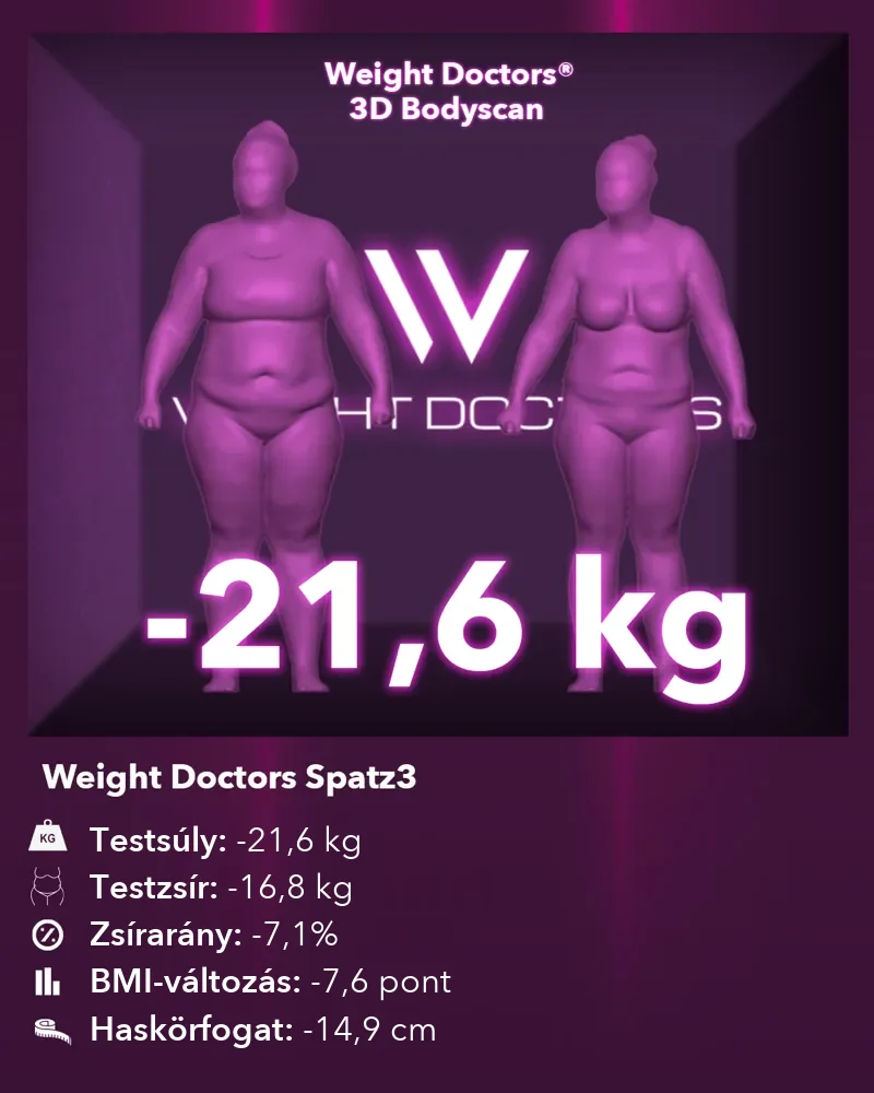 Weight Doctors® 3D Bodyscan előtte és utána: mínusz 21,6 kg a Spatz3 gyomorballon segítségével, testzsír mínusz 16,8 kg