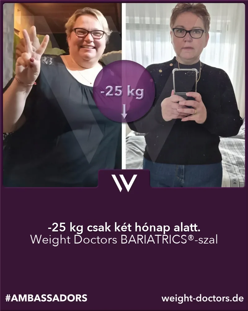 Weight Doctors® előtte–utána: páciens két hónap alatt mínusz 25 kg-mal, Weight Doctors BARIATRICS® eljárással