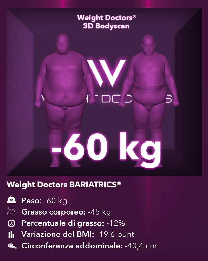 Weight Doctors® 3D Bodyscan prima e dopo: meno 60 kg con Weight Doctors BARIATRICS®, grasso corporeo meno 45 kg