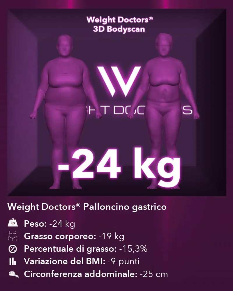 Weight Doctors® 3D Bodyscan prima e dopo: meno 24 kg con Weight Doctors® PALLONCINO GASTRICO, grasso corporeo meno 19 kg