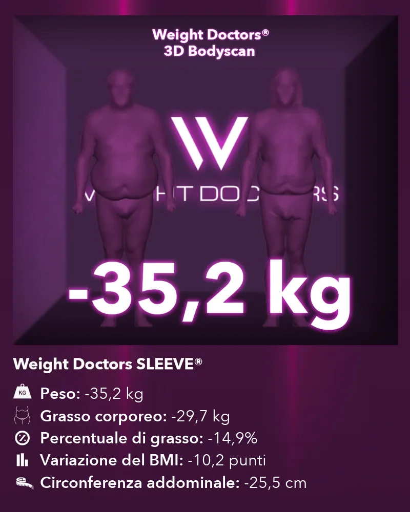 Weight Doctors® 3D Bodyscan prima e dopo: meno 35,2 kg con Weight Doctors SLEEVE®, grasso corporeo meno 29,7 kg