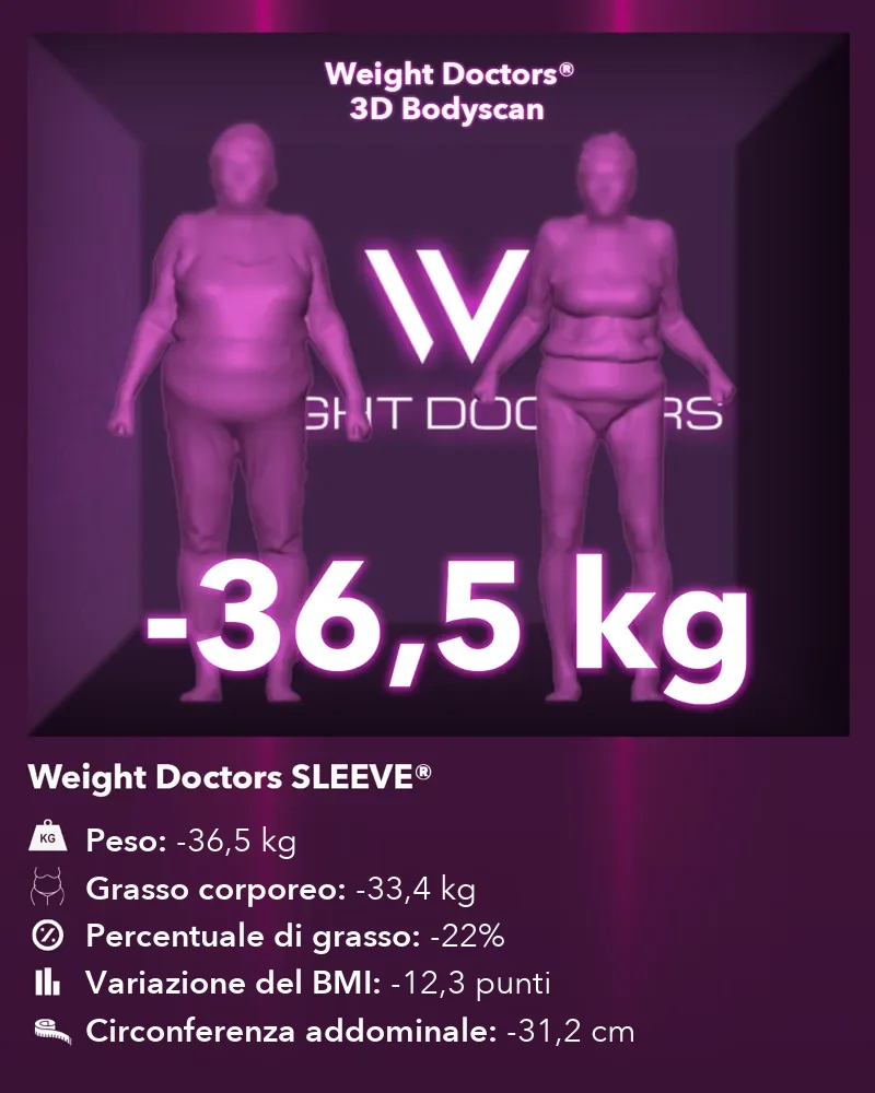 Weight Doctors® 3D Bodyscan prima e dopo: meno 36,5 kg con Weight Doctors SLEEVE®, grasso corporeo meno 33,4 kg