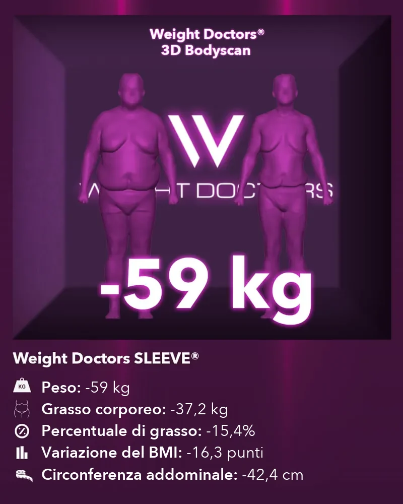 Weight Doctors® 3D Bodyscan prima e dopo: meno 59 kg con Weight Doctors SLEEVE®, grasso corporeo meno 37,2 kg