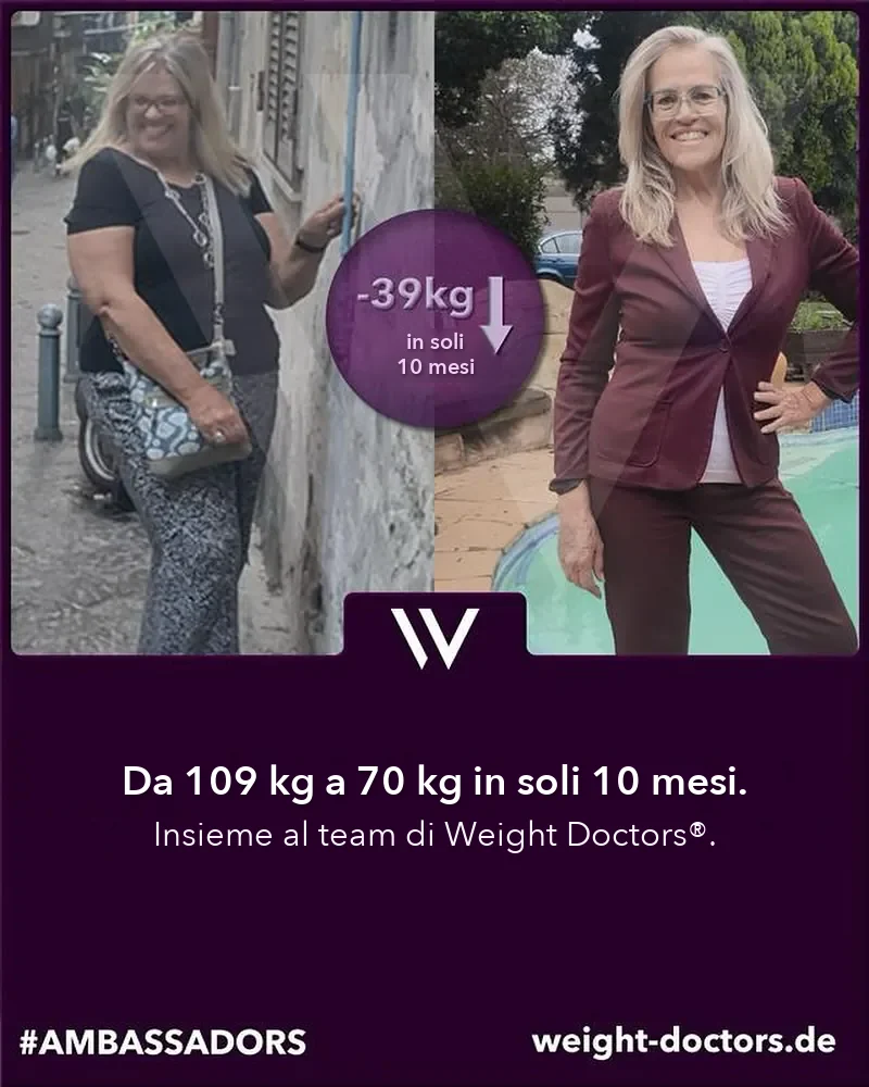 Weight Doctors® prima e dopo: paziente da 109 kg a 70 kg in dieci mesi, insieme al team di Weight Doctors®