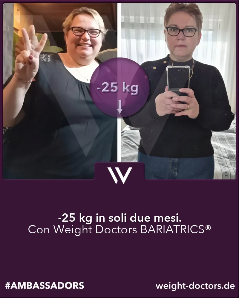 Weight Doctors® prima e dopo: paziente con 25 kg in meno in due mesi, con Weight Doctors BARIATRICS®