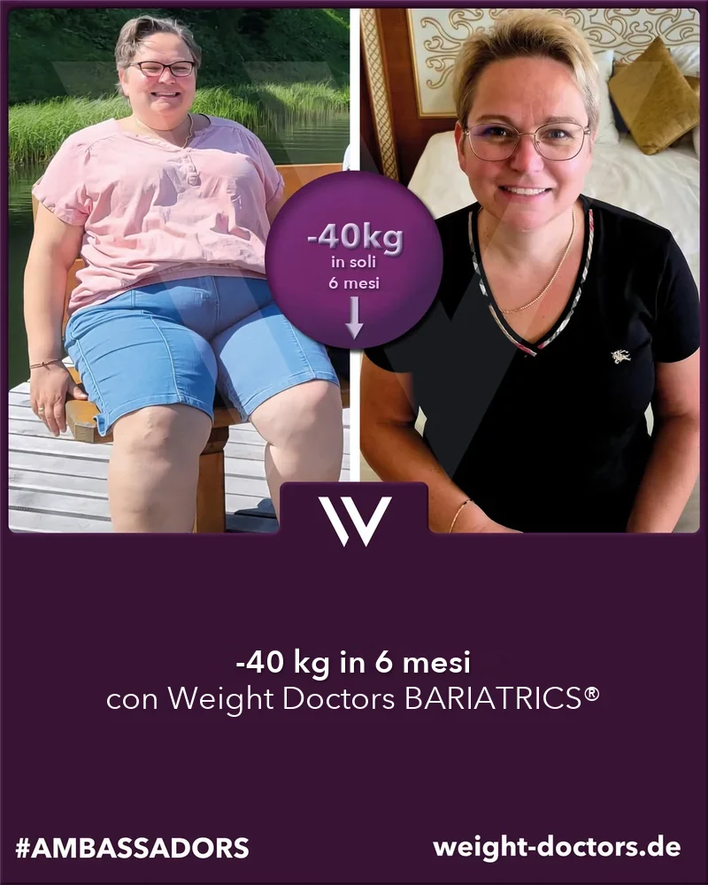Weight Doctors® prima e dopo: paziente con 40 kg in meno in sei mesi, con Weight Doctors BARIATRICS®