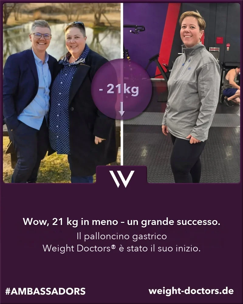 Weight Doctors® prima e dopo: Elli con 21 kg in meno, con Weight Doctors® PALLONCINO GASTRICO