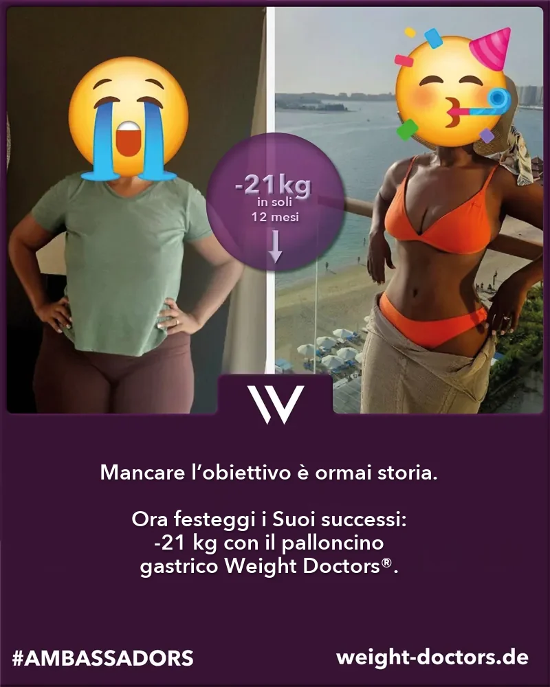 Weight Doctors® prima e dopo: paziente con 21 kg in meno in dodici mesi, con il Weight Doctors® PALLONCINO GASTRICO (volti coperti)