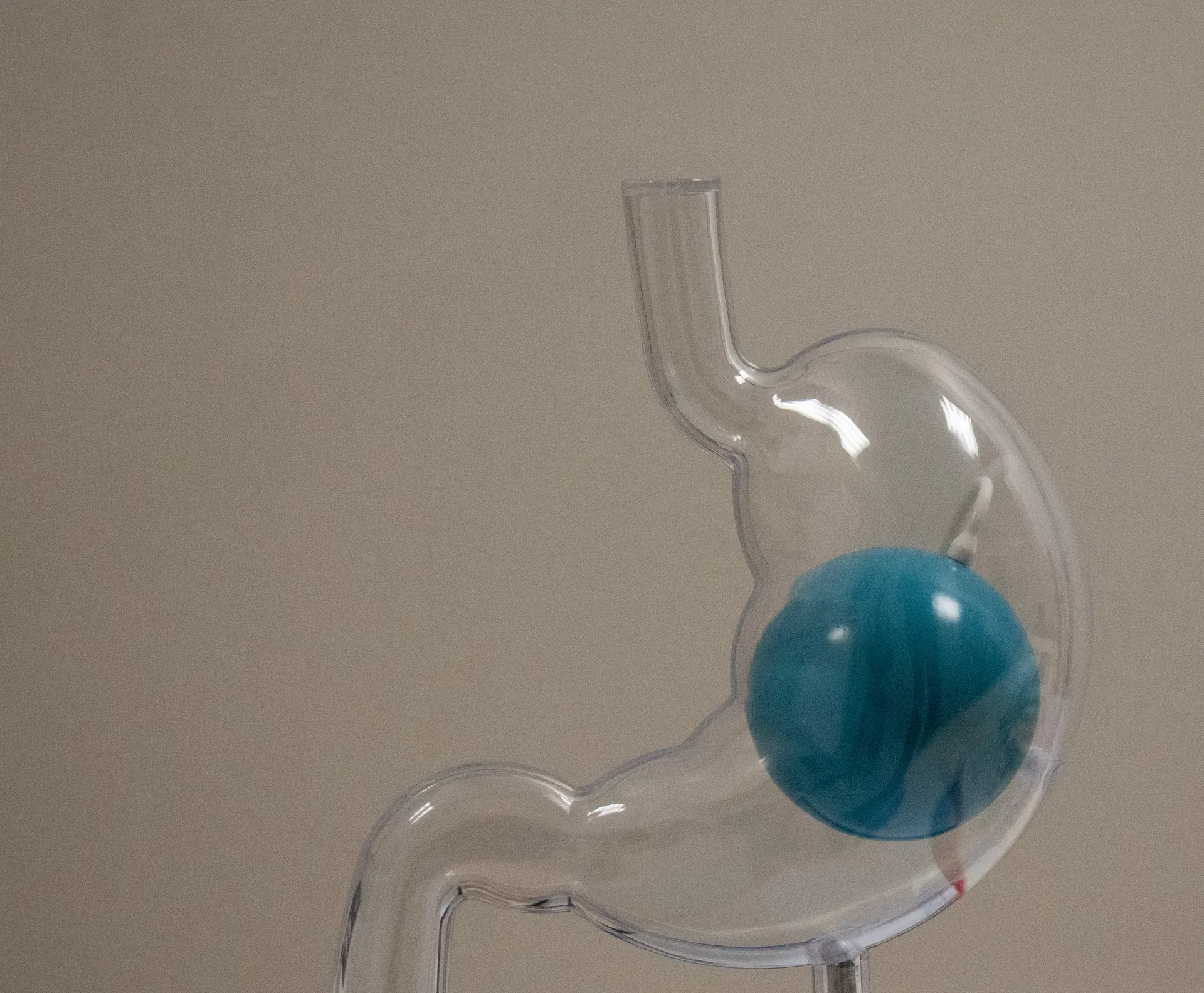 Modello trasparente di stomaco con un palloncino gastrico